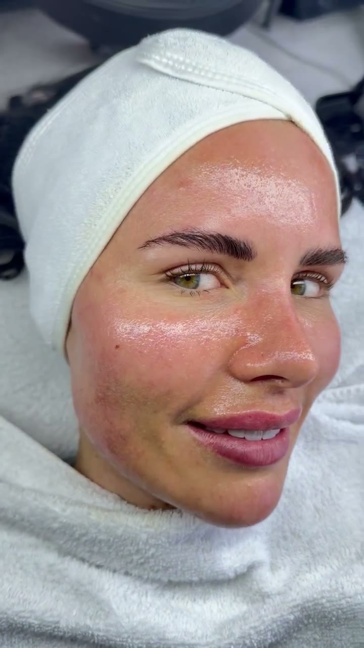 Aquafacial – Behandlung im Glam Beauty Studio Garching