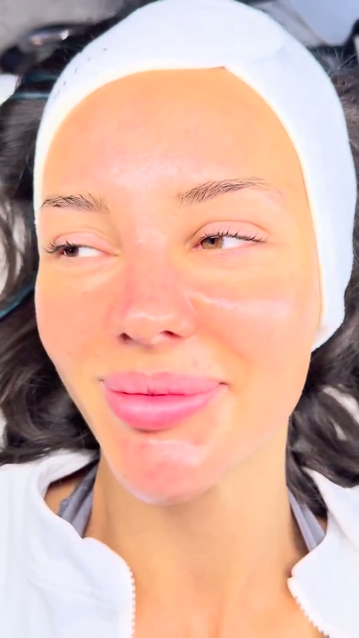 Aquafacial – Sichtbares Hautergebnis im Glam Beauty Studio Garching